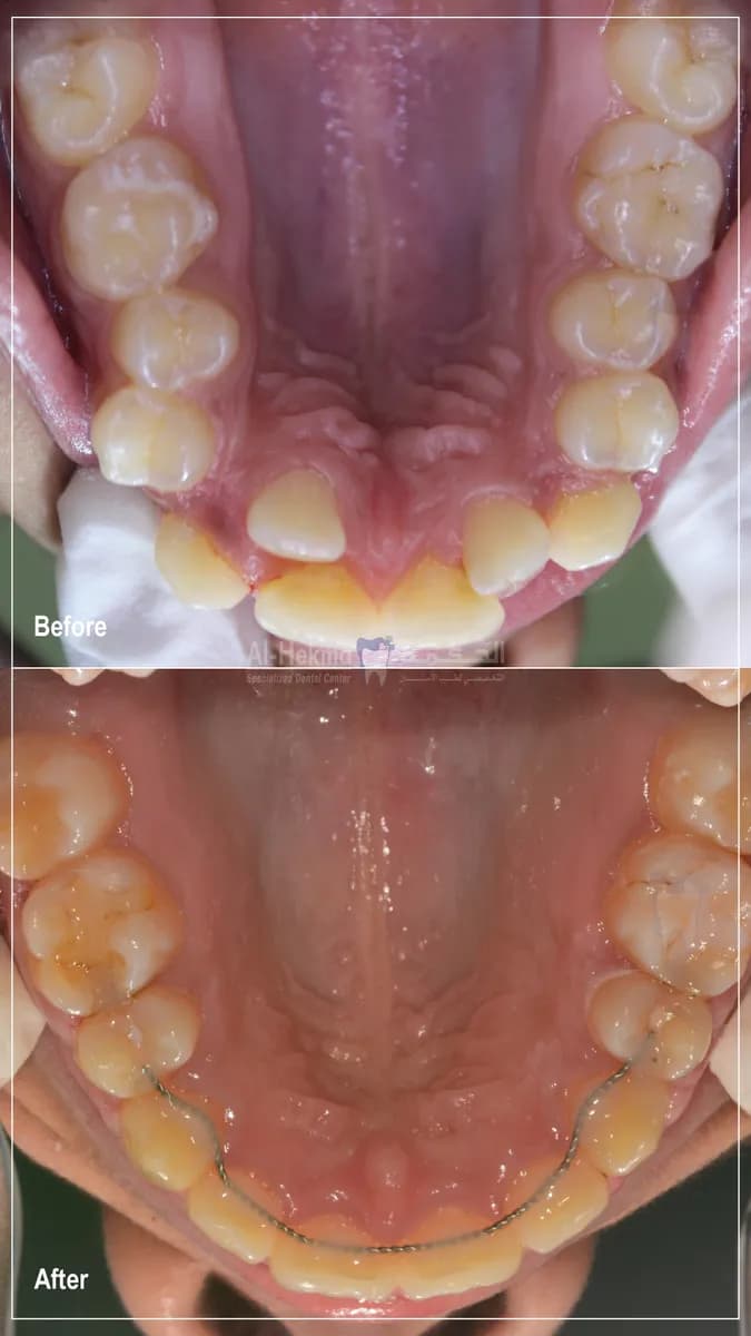 Al Hekma Dental Center - Murqab — صورة 8