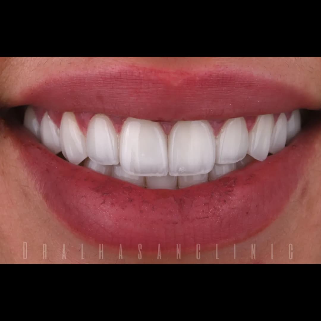 Dr. AlHasan Dental Clinic — صورة 2