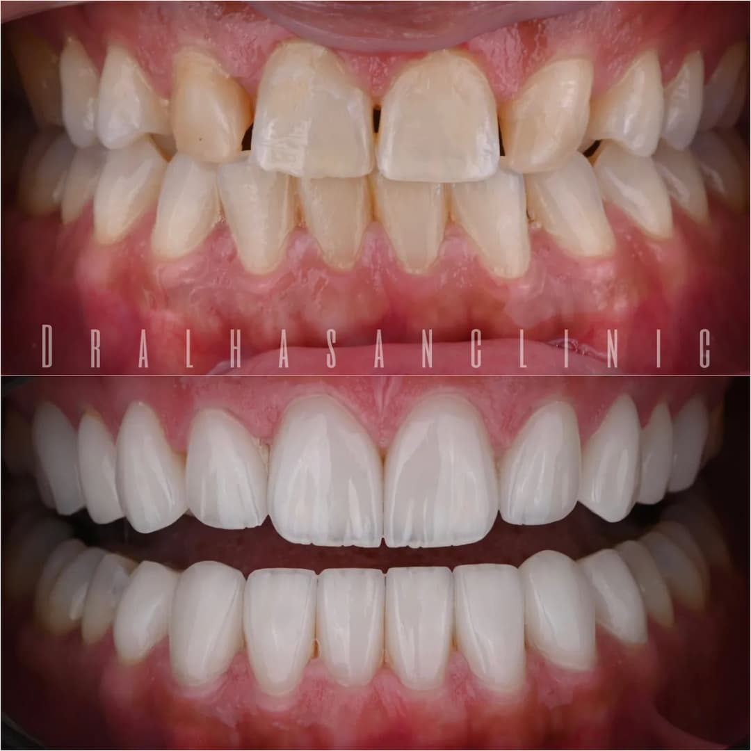 Dr. AlHasan Dental Clinic — صورة 3
