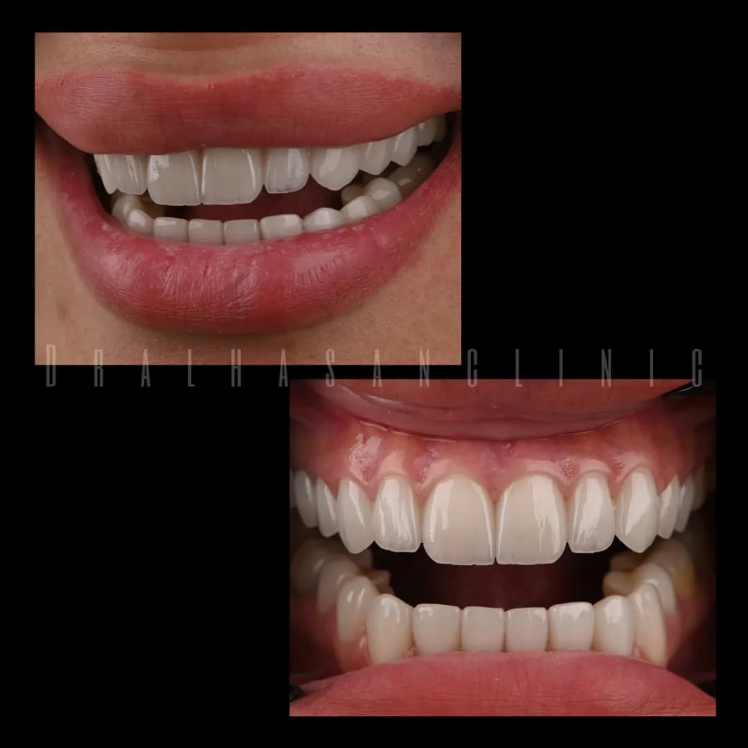 Dr. AlHasan Dental Clinic — صورة 6
