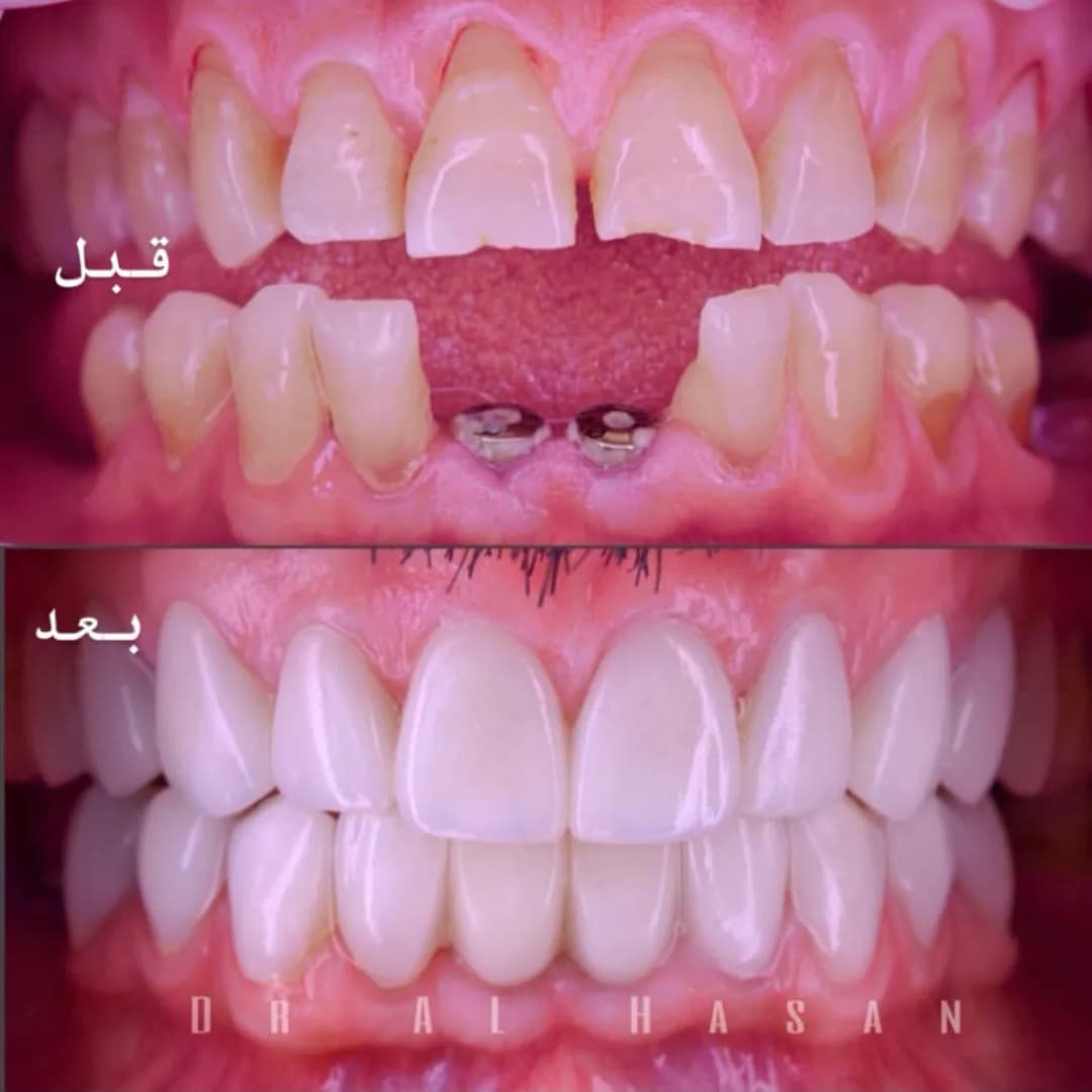 Dr. AlHasan Dental Clinic — صورة 7