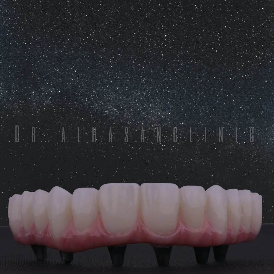 Dr. AlHasan Dental Clinic — صورة 8