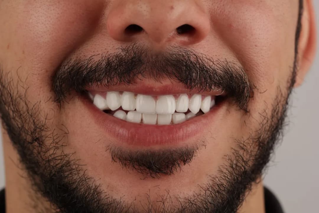 عيادة الأسنان نيو ريان — صورة 4