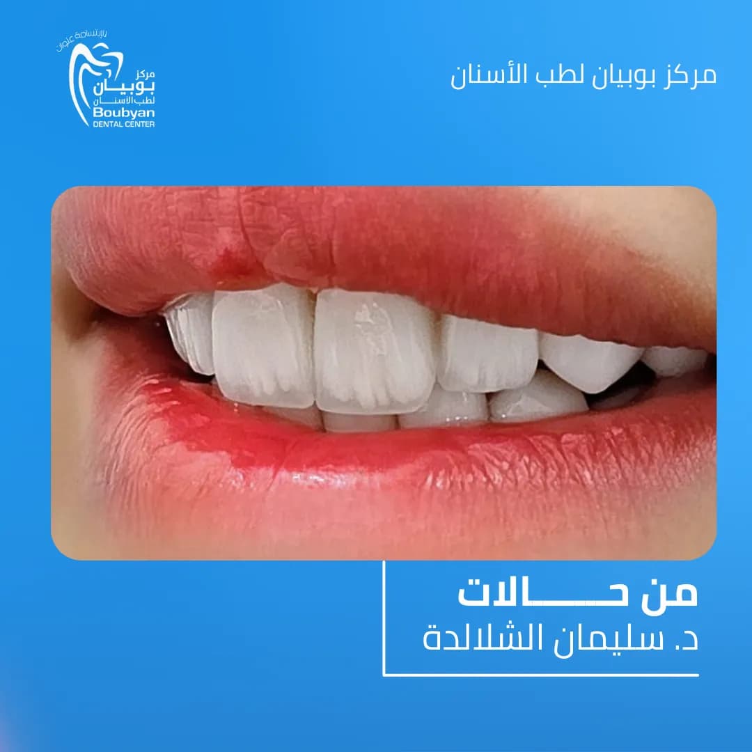 Boubyan Dental Center — صورة 7