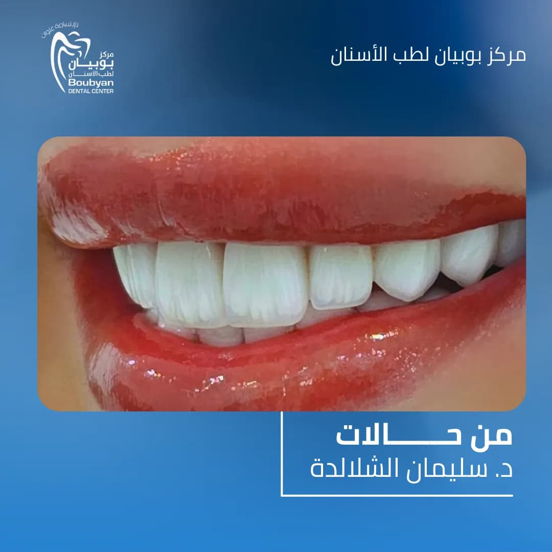 Boubyan Dental Center — صورة 8