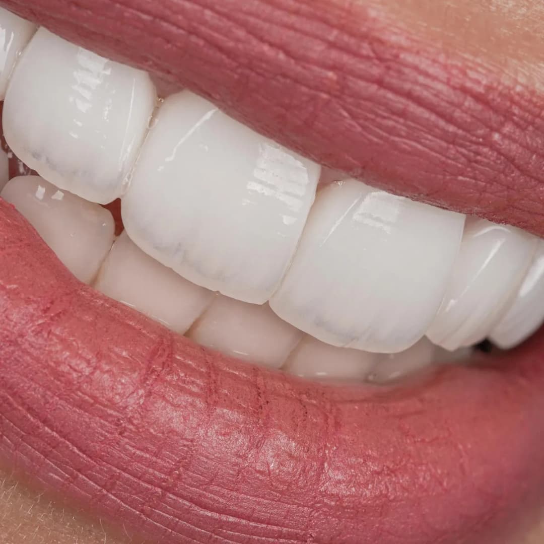 مركز الدكتور نائل الهزيم لجراحة الوجه والفكين والأسنان - NHC Dr. Nael Al Hazeem Dental Center Kuwait — صورة 8