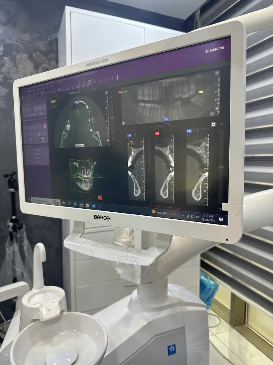 مركز دايموند لطب الأسنان فرع الجهراء — صورة 6
