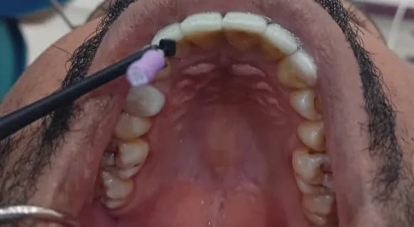 طوارئ أسنان — صورة 5