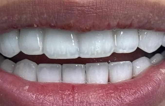 Gulf Dental Center Duhail — صورة 3