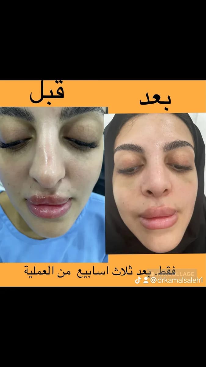 افضل جراح تجميل في قطر د كمال صالح — صورة 2