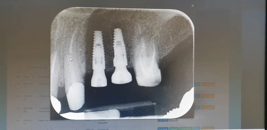 مركز اتقان للاسنان Itcan Dental Center — صورة 5