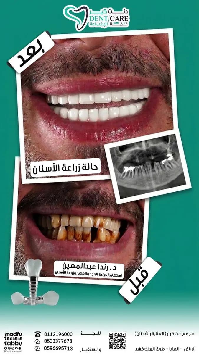 مجمع عيادات دنت كير لطب الأسنان | Dent Care Clinic