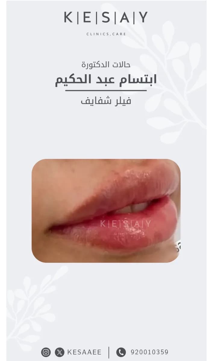 Kesay — صورة 3