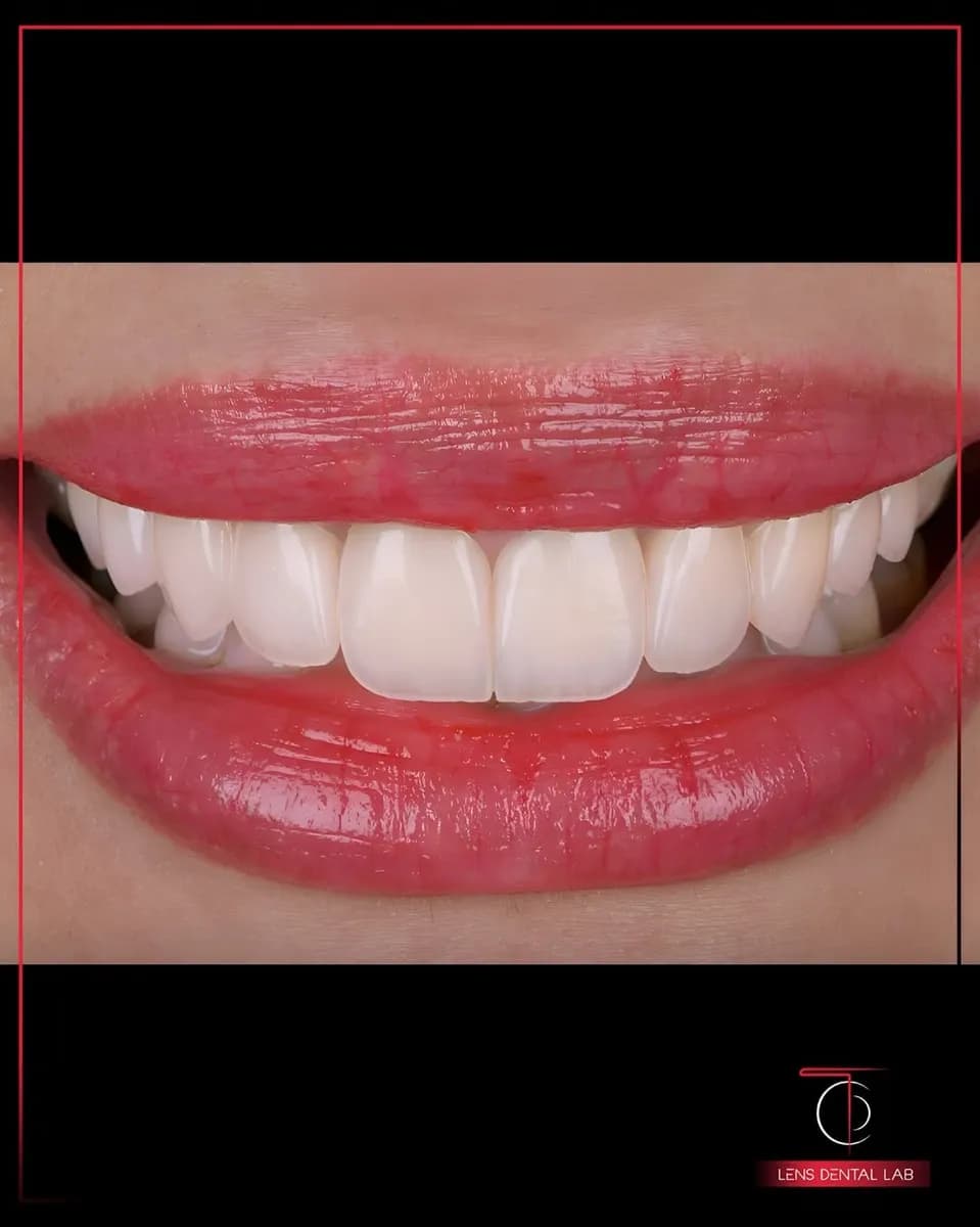 Lens Dental Lab