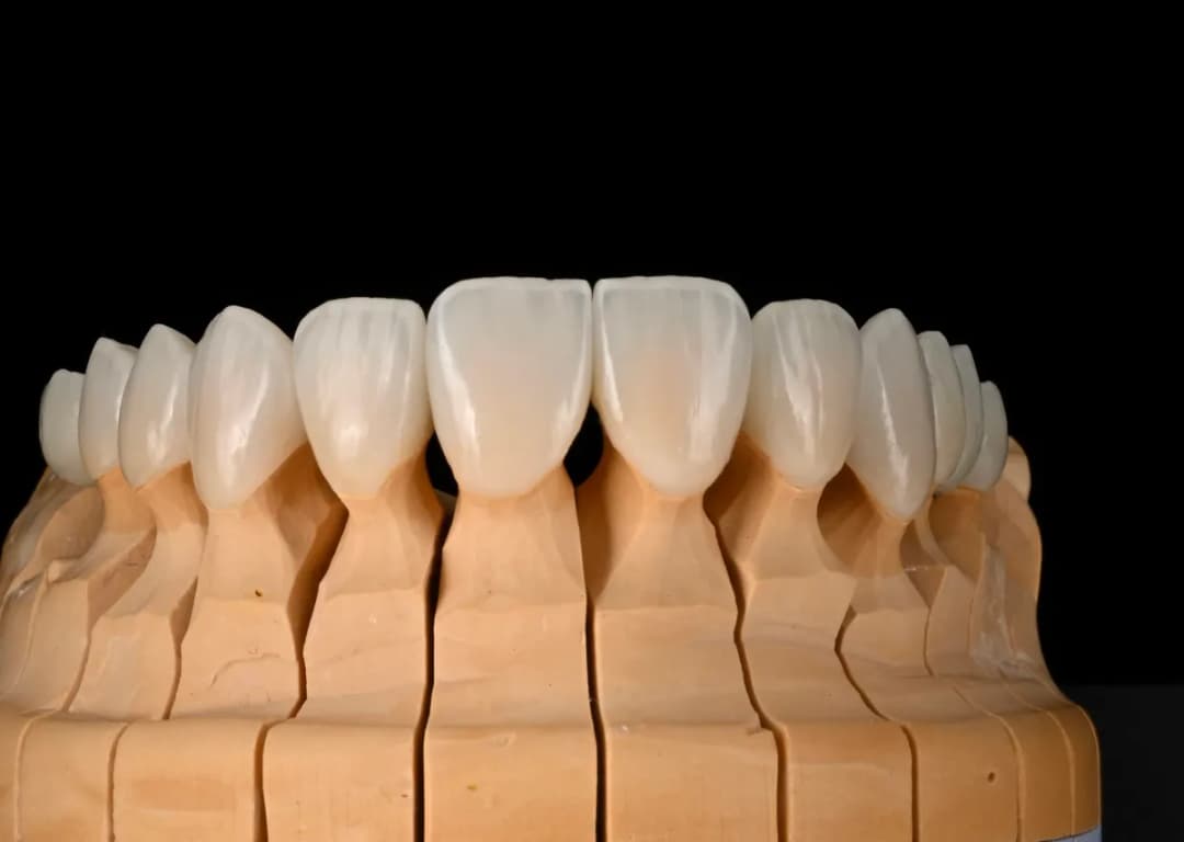 Lens Dental Lab — صورة 6