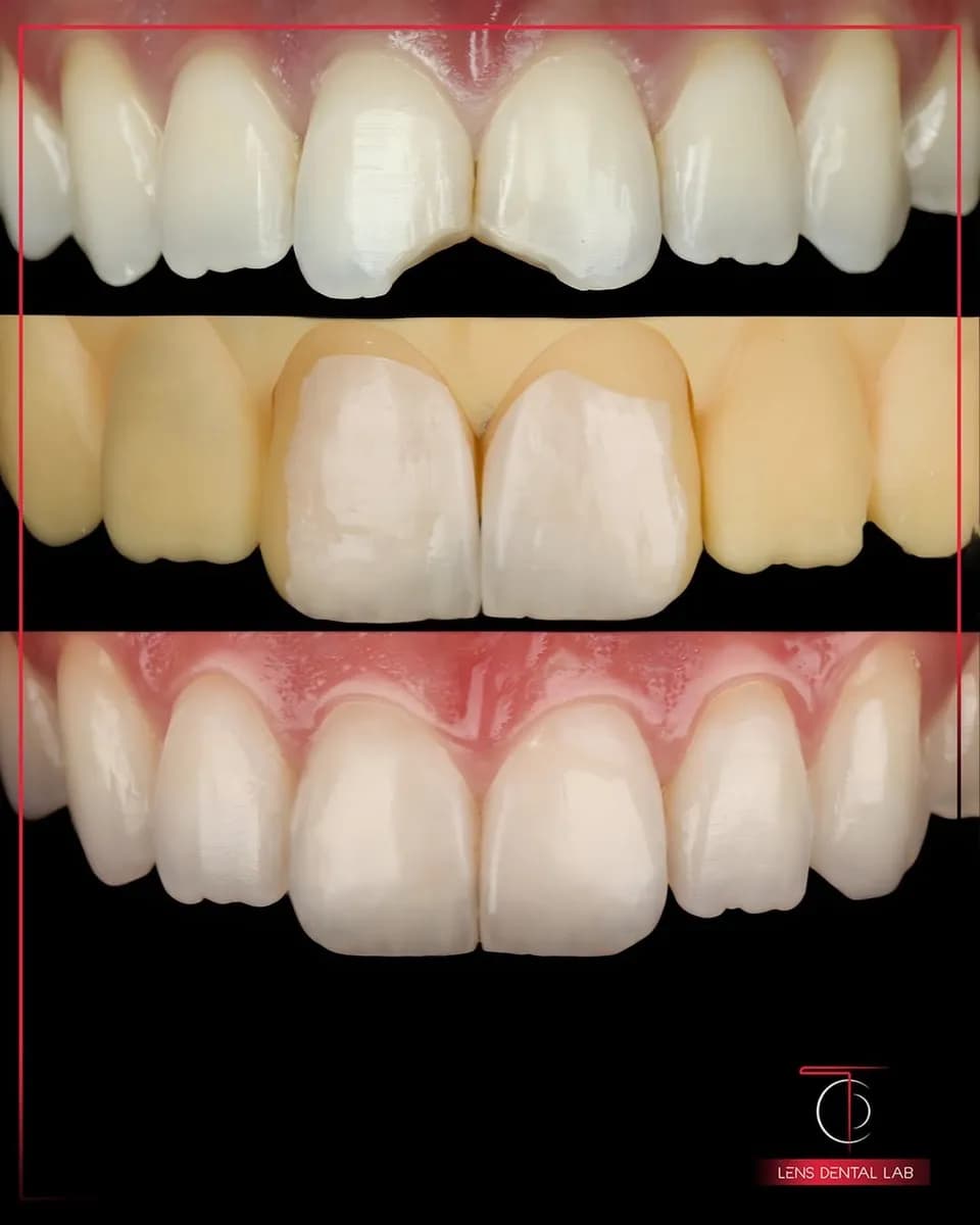 Lens Dental Lab — صورة 8