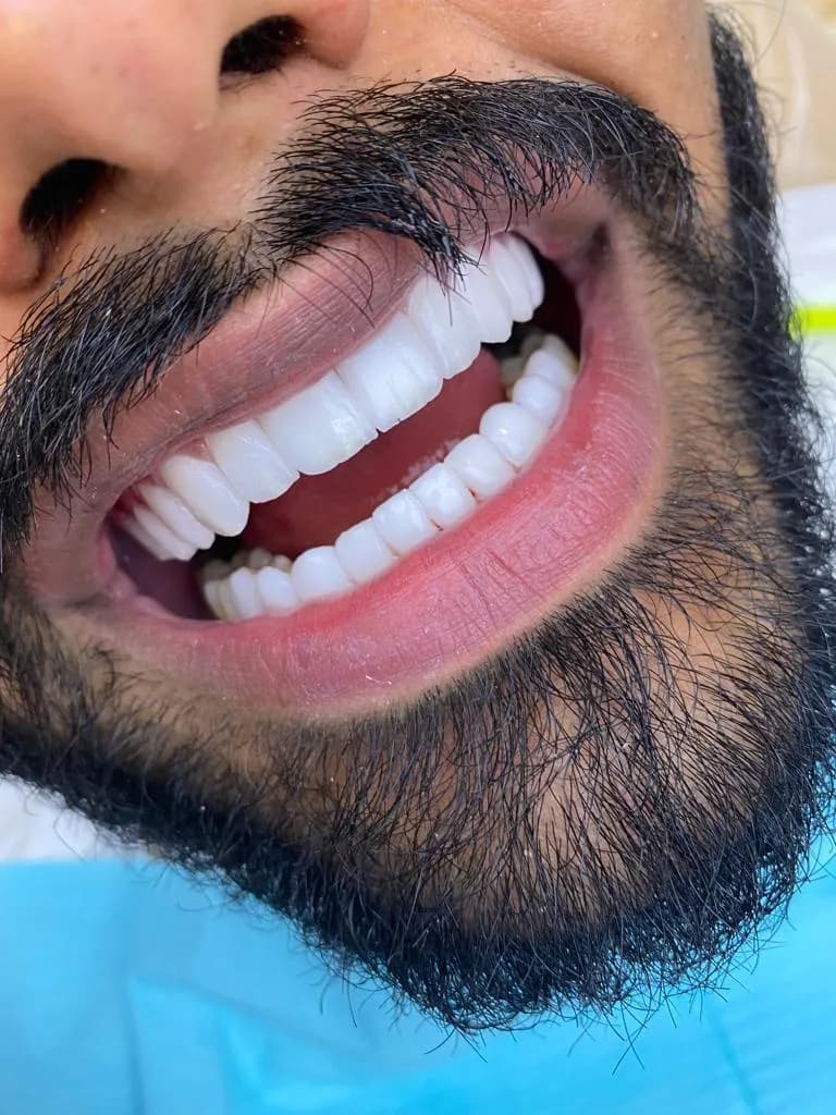 ماسة الصفوة لطب الاسنان فرع أبها — صورة 3