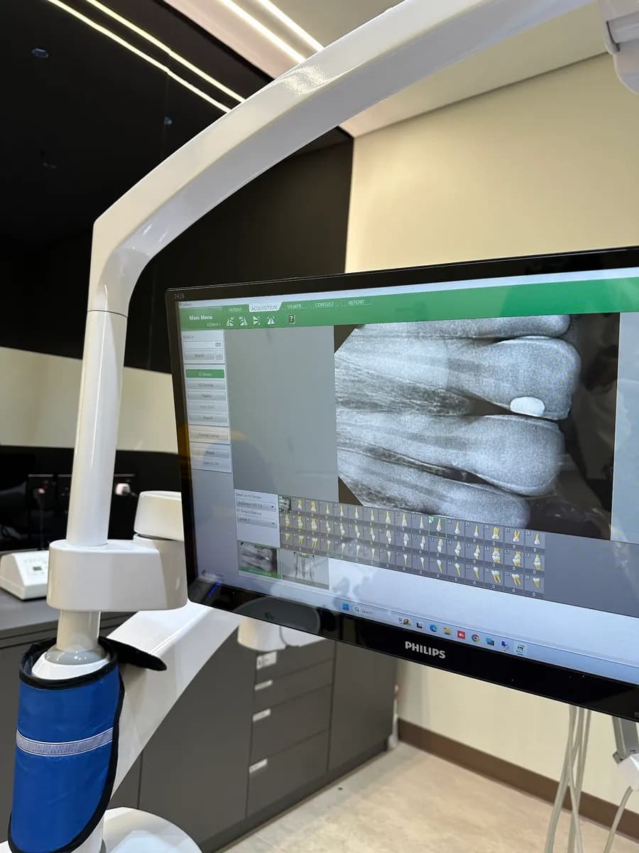 SaudiDent Clinic - Abha سعودي دنت لطب الأسنان - أبها — صورة 5