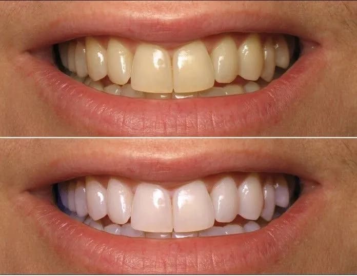 مجمع دنتال هوم لطب وزراعة الأسنان Dental Home Clinic — صورة 3