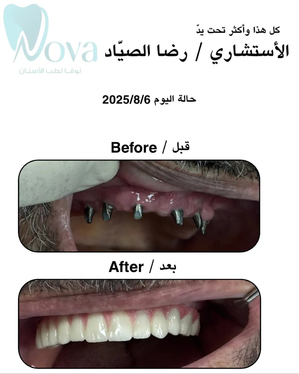 مجمع نوفا لطب الأسنان — صورة 8
