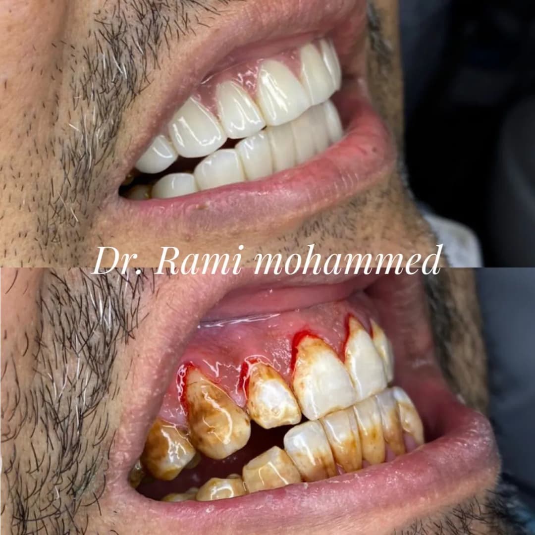 صفوة المهيدب لطب الأسنان الخرج حي المنتزه — صورة 5