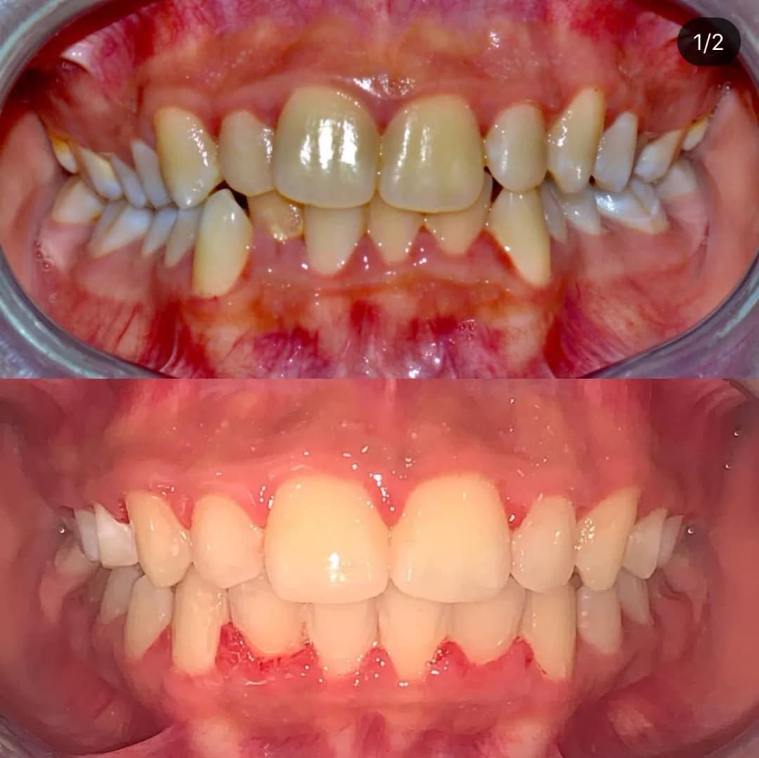 Dr. Mohamed Saif Orthodontic Specialtist — صورة 2