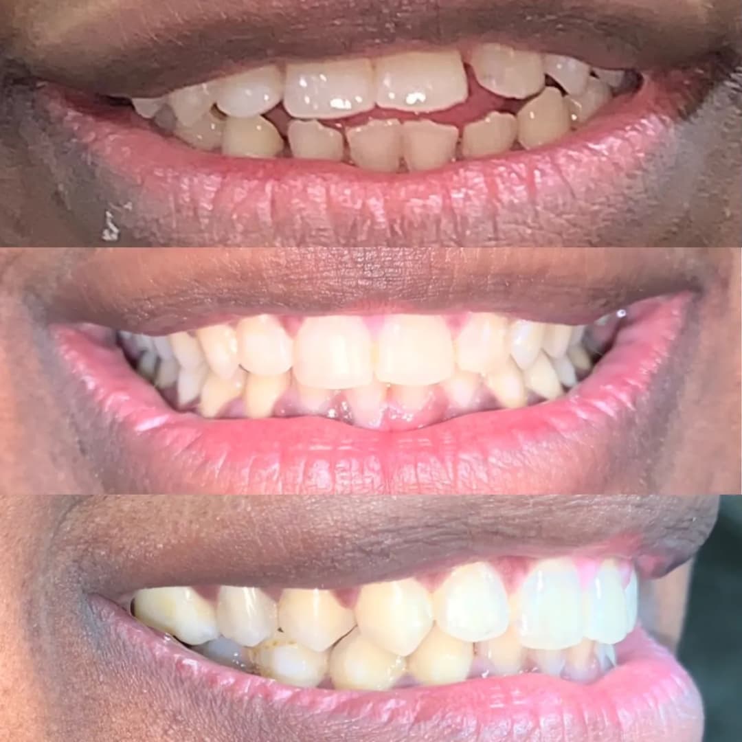 Dr. Mohamed Saif Orthodontic Specialtist — صورة 7