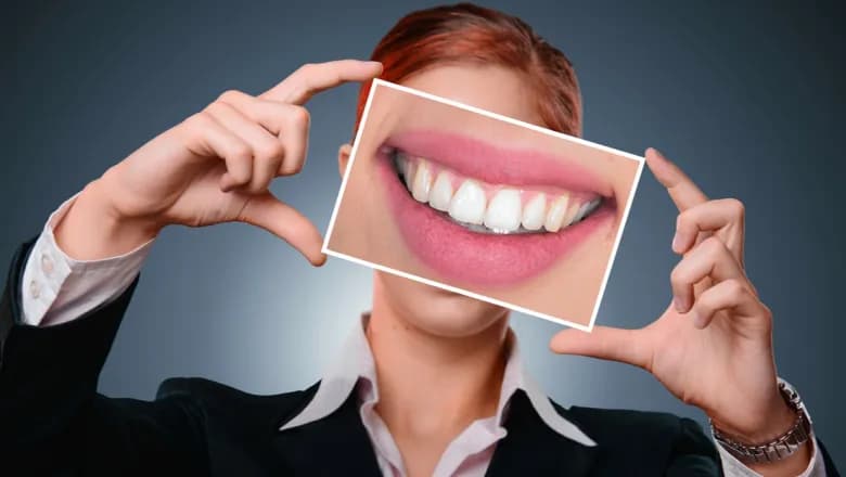 الماس لطب الأسنان Almass dental clinic