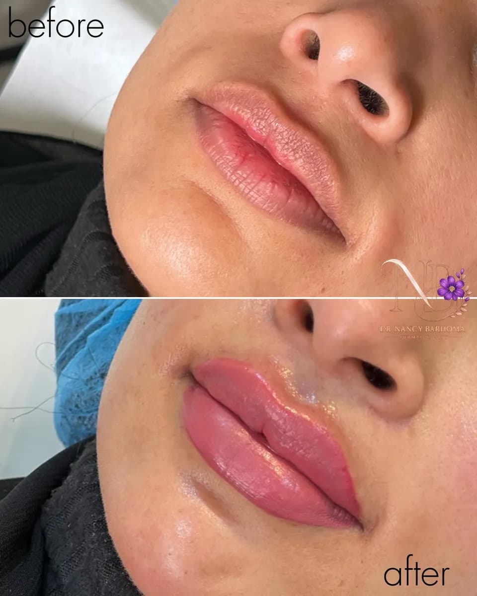 عيادة الجلدية و التجميل الدكتورة نانسي برهومه — صورة 8