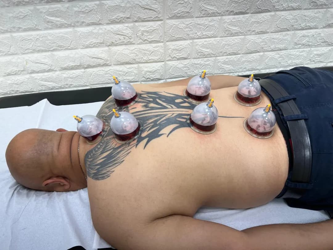 Hijama Center