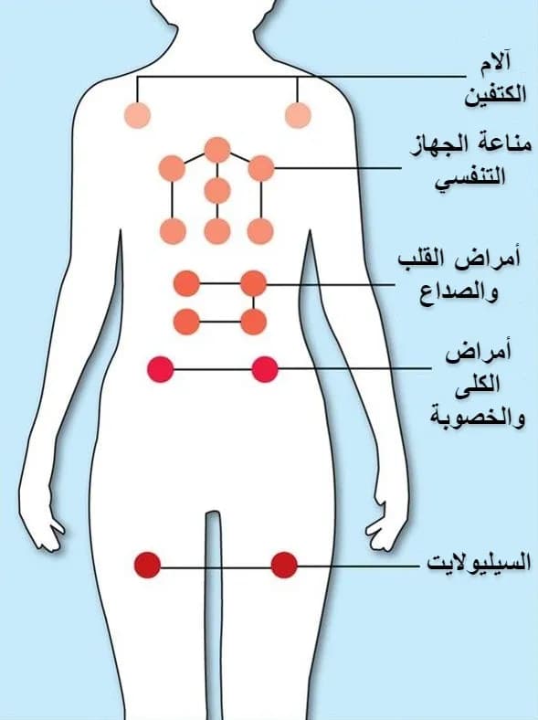 Hijama Center — صورة 7