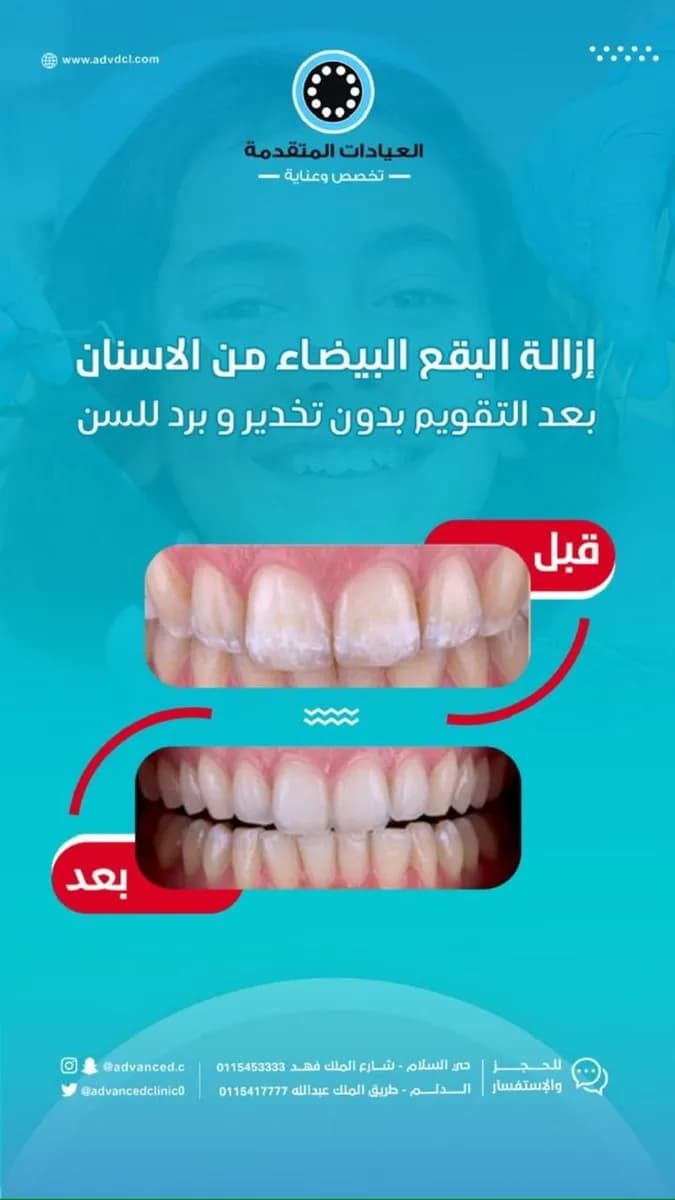Advanced Dental Clinics — صورة 6