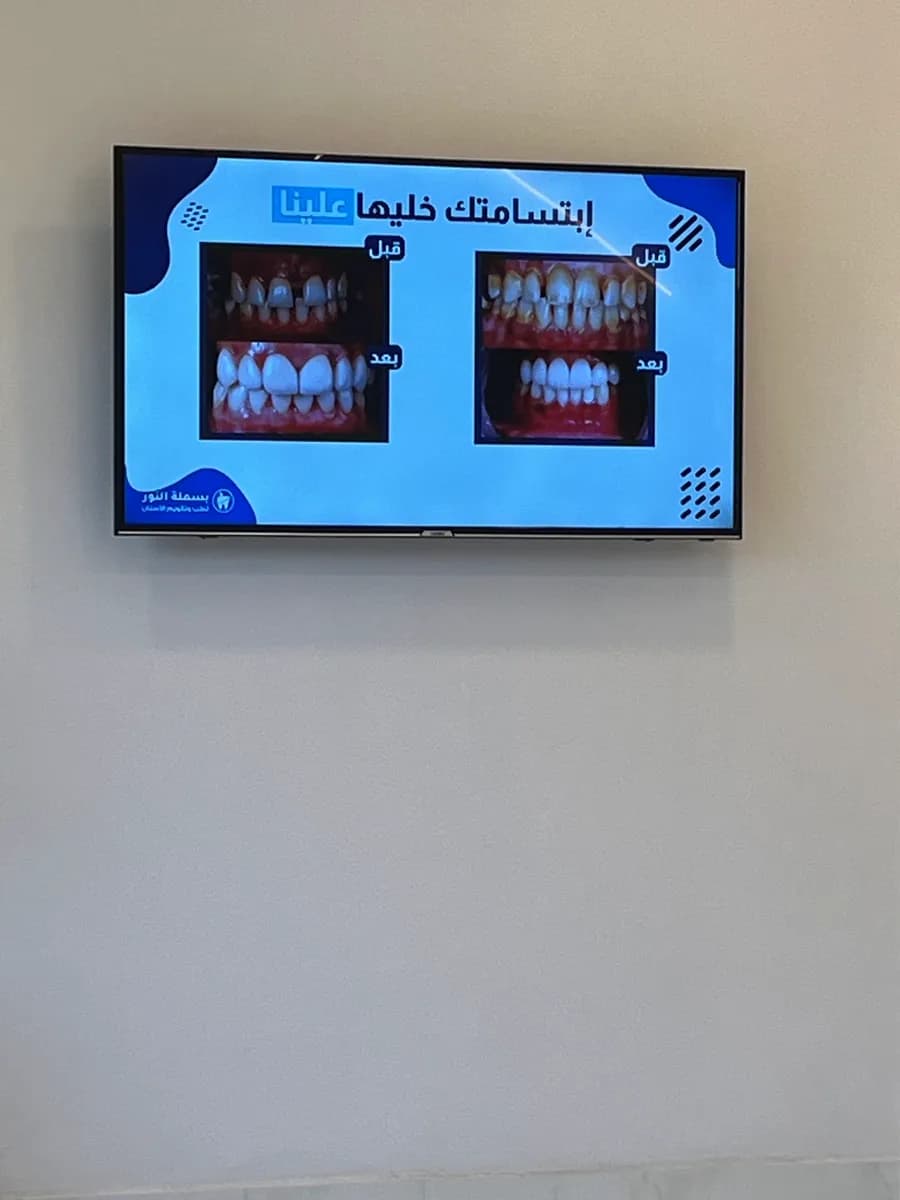 بسملة النور لطب وتقويم الأسنان Basmalah Alnoor Dental Center — صورة 5