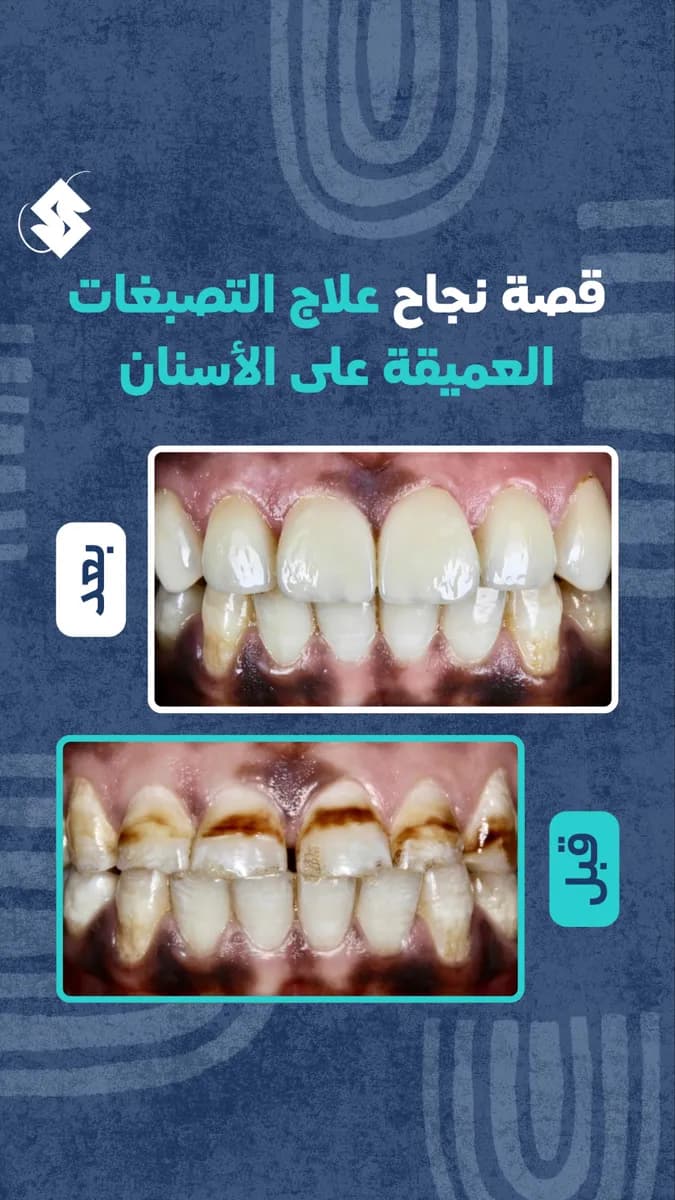 Dr.Salem Alablan — صورة 7