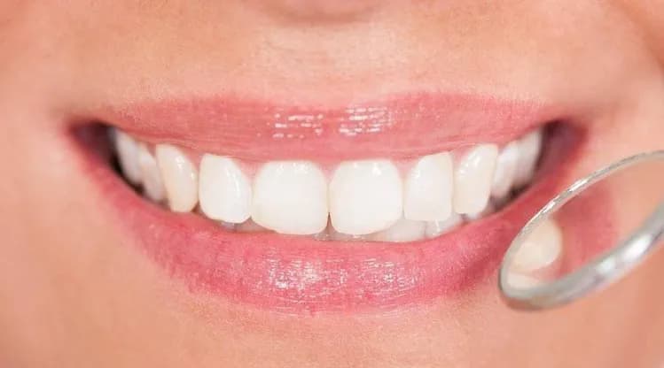 مركز إ��ج لطب الأسنان — صورة 2