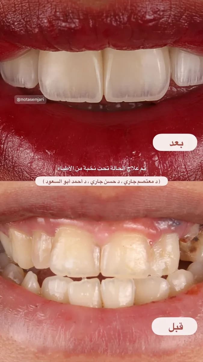 صفوة المهيدب لطب الاسنان المدينة المنورة حي القبلتين — صورة 5