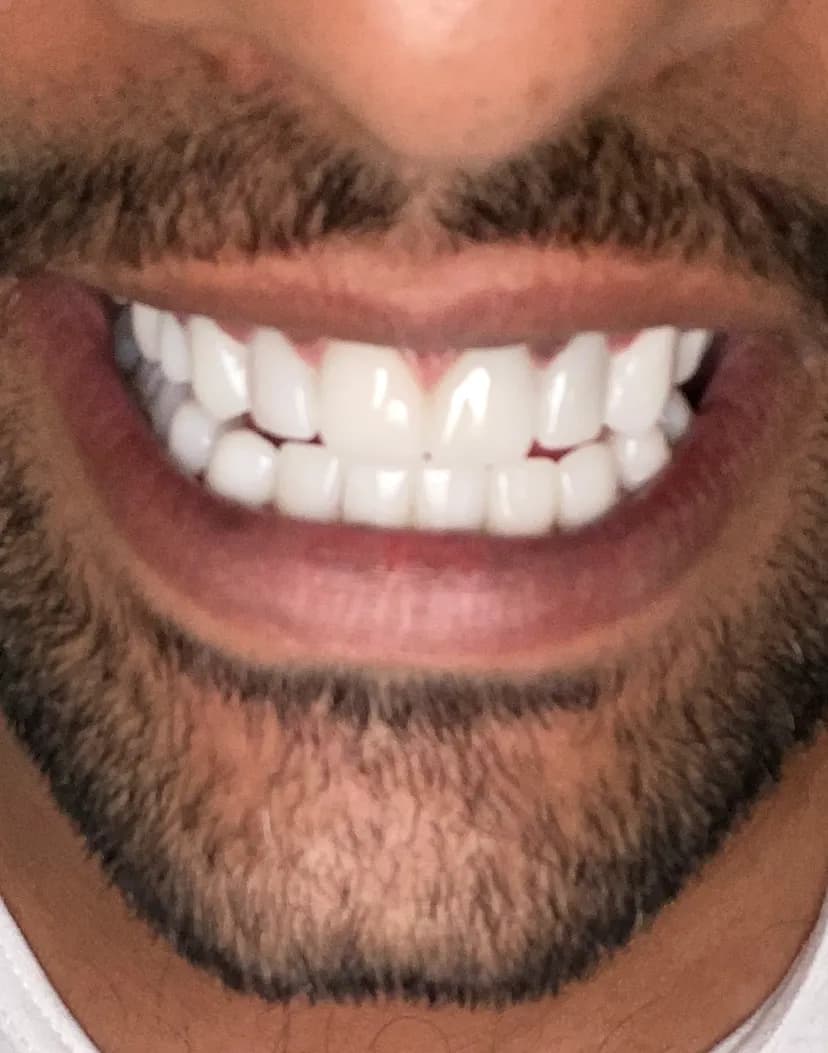 صفوة المهيدب لطب الاسنان المدينة المنورة حي القبلتين — صورة 8