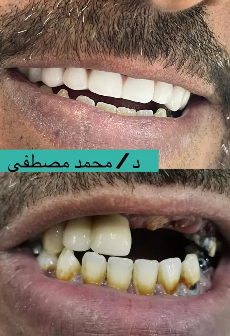 صفوة المهيدب لطب الأسنان — صورة 8