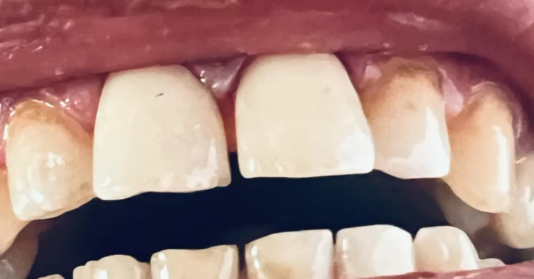 عيادات ركن البسمة لطب وتقويم الأسنان — صورة 4