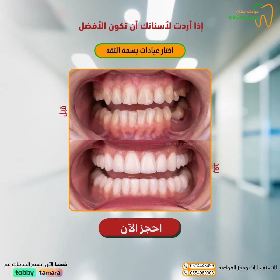 عيادات ركن البسمة لطب وتقويم الأسنان — صورة 6