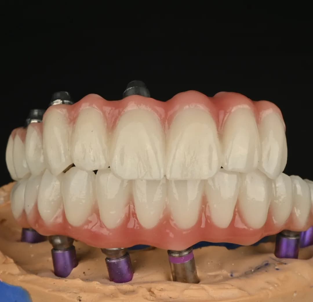 عيادات جرين دنت لتجميل وزراعة الأسنان Green Dent Dental Clinic — صورة 5