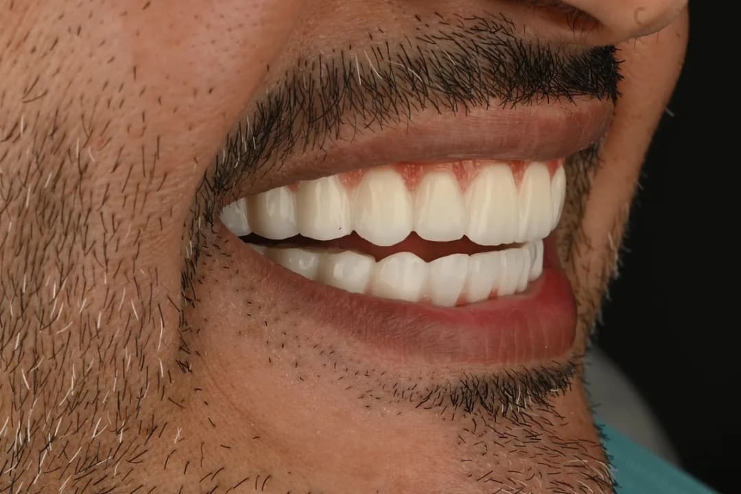 عيادات جرين دنت لتجميل وزراعة الأسنان Green Dent Dental Clinic — صورة 7