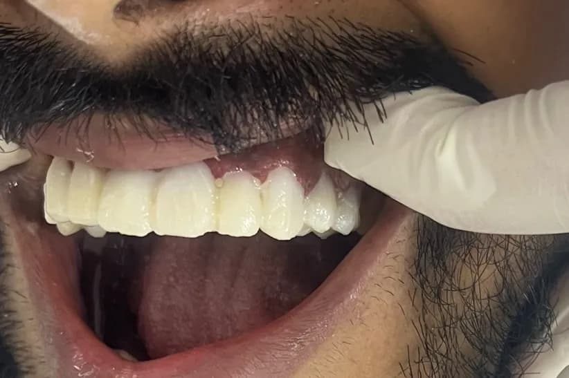المهيدب لطب الأسنان الخبر حي الجسر — صورة 5