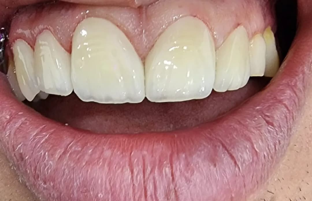 صفوة المهيدب لطب الأسنان ، خميس مشيط , طريق المدينة العسكرية — صورة 5