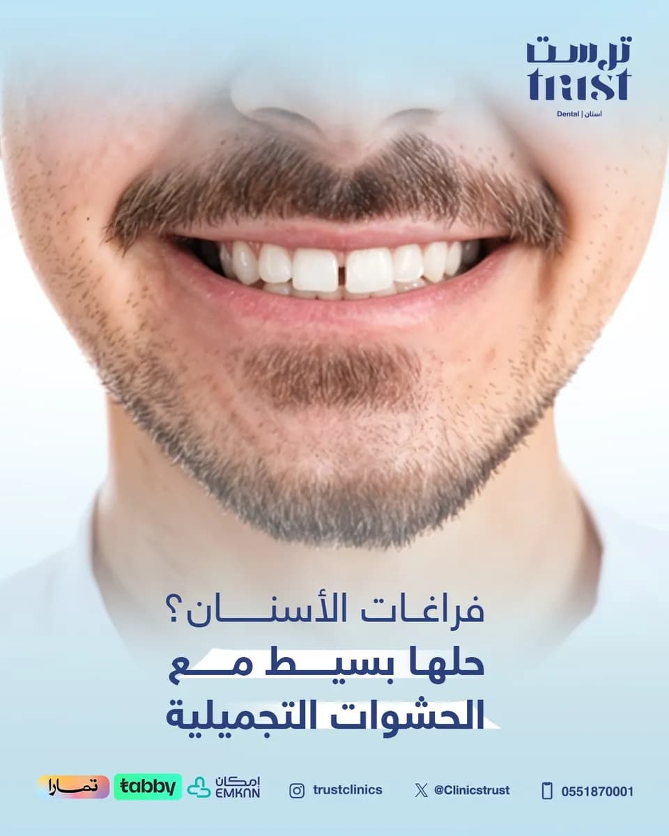 عيادات ترست ( عيون - تجميل - اسنان) — صورة 7
