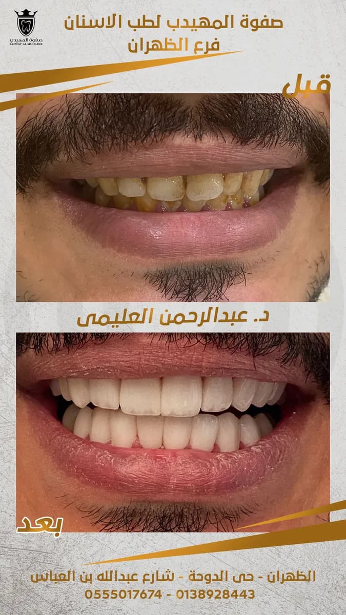 صفوة المهيدب لطب الأسنان الظهران — صورة 3