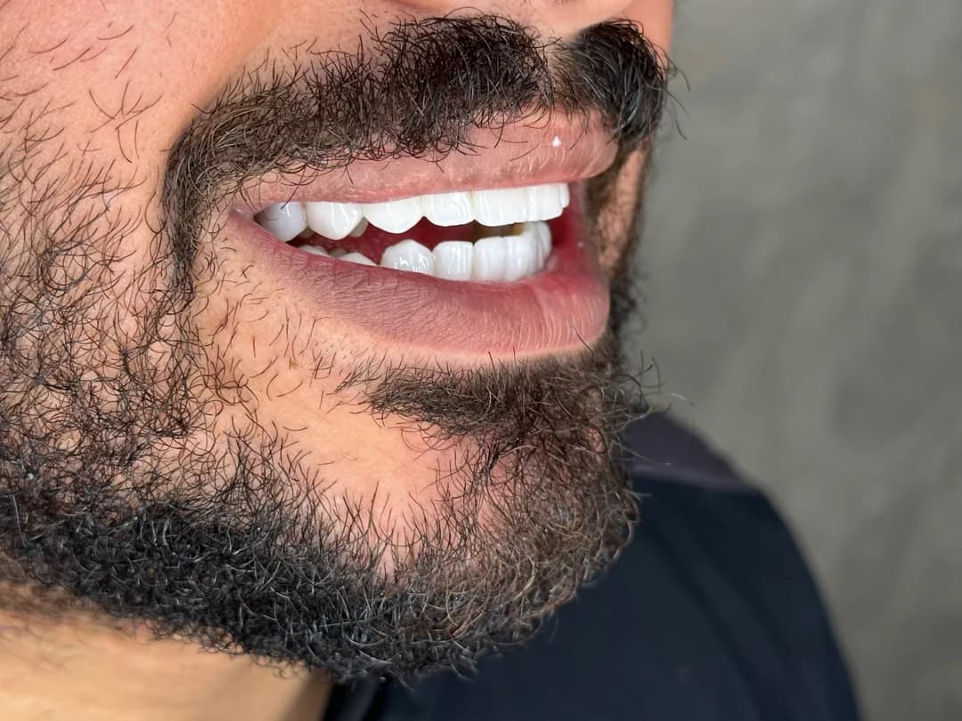 صفوة المهيدب لطب الأسنان الظهران — صورة 6