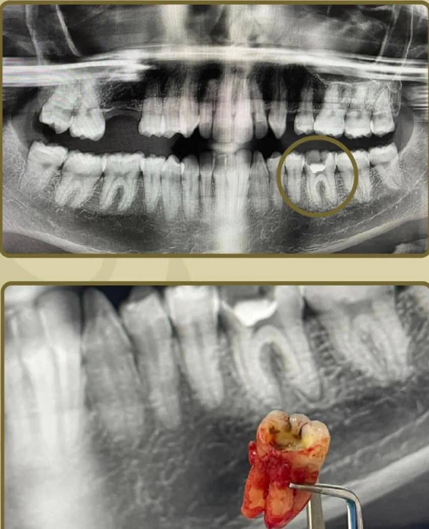 لتين لطب الأسنان| Lateen Medical Center — صورة 8