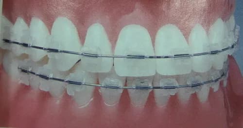 مجمع عيادات طابة دنت لطب الأسنان - حائل — صورة 8