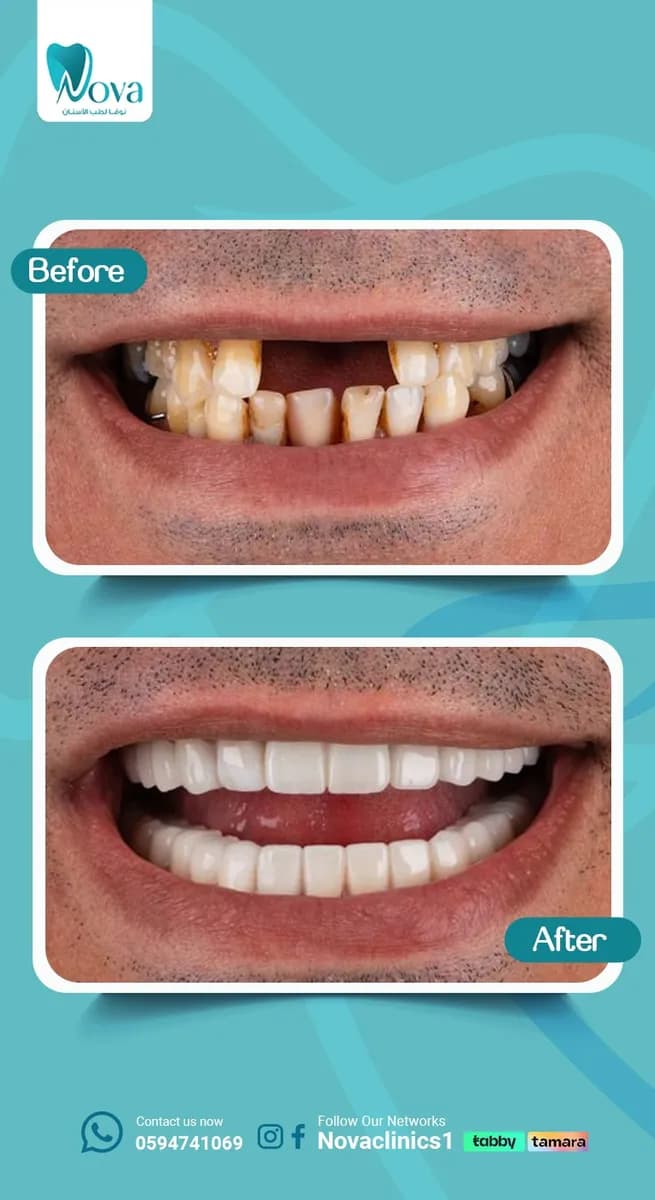 Nova Dental Clinics — صورة 3